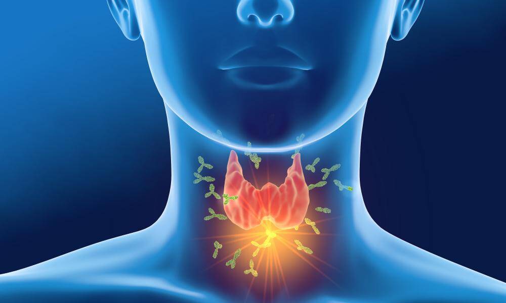 Hypothyroidism: Thyroid myths, symptoms and the real solution